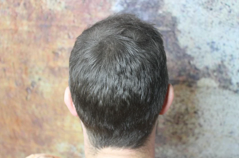 Before Image